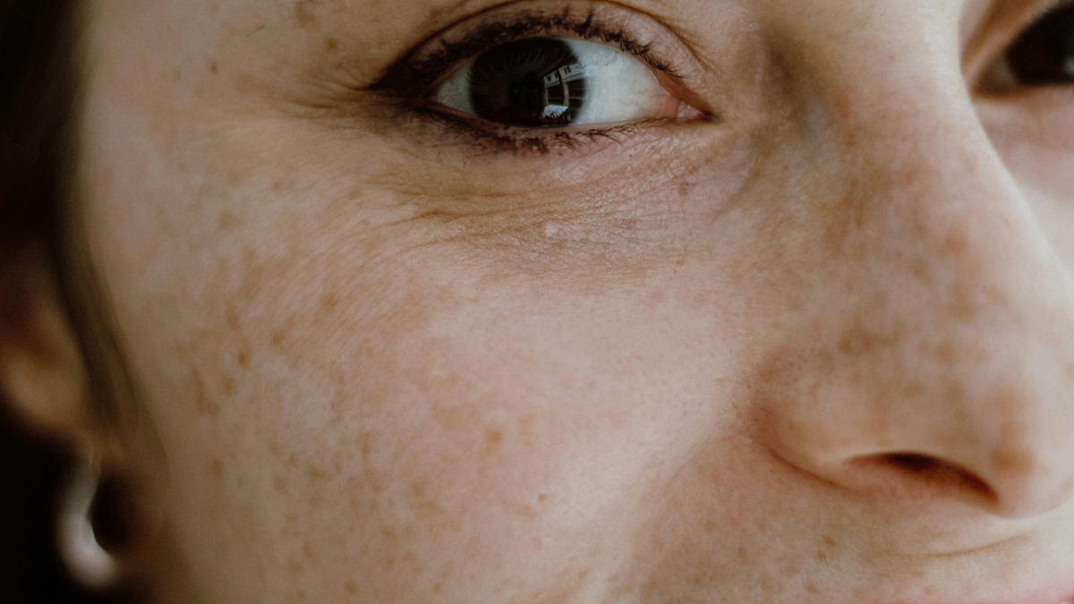 Why Your Skincare Isn’t Working (And What Your Pores Are Trying to Tell You)