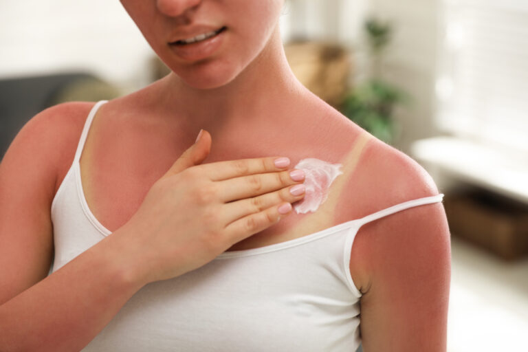 The Importance of Your Skincare Routine Before and After Sunscreen Use 