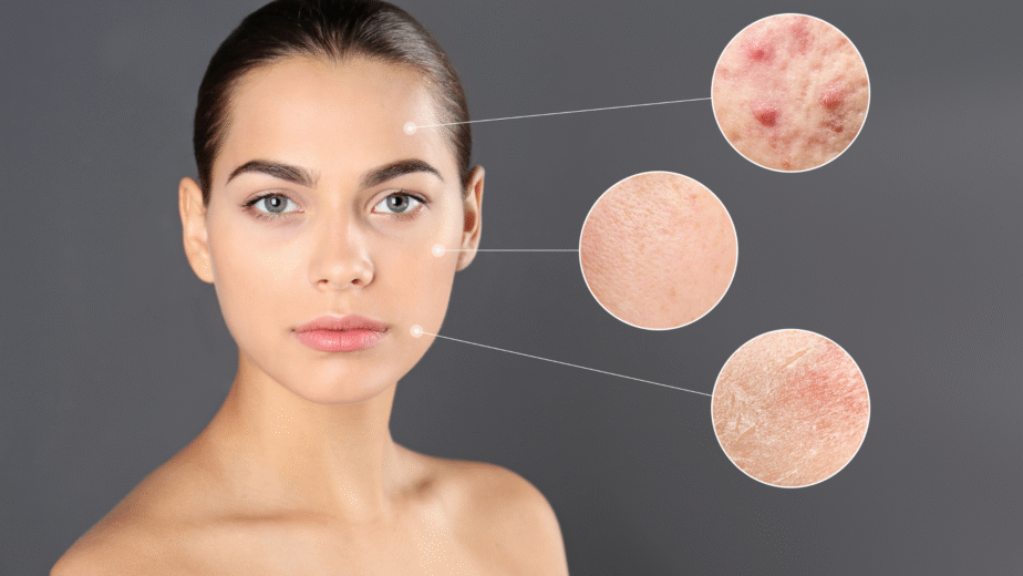 skin microbiome health