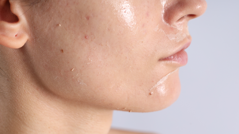 Is Your Skin Sensitive — or Just Overworked?