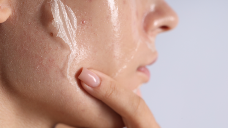 What Is TEWL? The Hidden Reason Your Skin Feels Dry—No Matter What You Use 